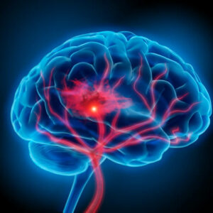 Brain Injury Policy (Care Homes) £27